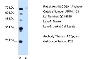 WB Suggested Anti-SLCO6A1  Antibody Titration: 1. (SLCO6A1 anticorps  (C-Term))