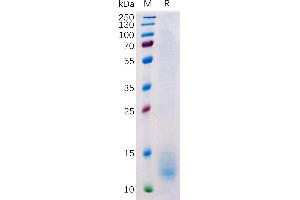 Human BCMA Protein, His Tag on SDS-PAGE under reducing condition.