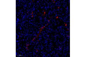 Immunofluorescence of paraffin embedded mouse nephritis using TBCldl (ABIN7075843) at dilution of 1:1000 (250x lens)
