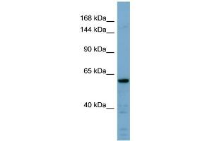 WB Suggested Anti-CDH23 Antibody Titration:  0. (CDH23 anticorps  (Middle Region))