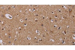 Immunohistochemistry of paraffin-embedded Human brain using MCTS1 Polyclonal Antibody at dilution of 1:60 (MCTS1 anticorps)