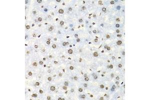 Immunohistochemistry of paraffin-embedded mouse liver using IGF2BP2 antibody at dilution of 1:100 (40x lens). (IGF2BP2 anticorps)