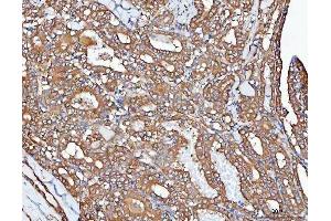 IHC analysis of PPP2CA using anti-PPP2CA antibody (ABIN3043356). (PPP2CA anticorps  (AA 1-309))