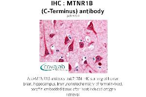 Image no. 1 for anti-Melatonin Receptor 1B (MTNR1B) (C-Term), (Cytoplasmic Domain) antibody (ABIN1737120) (Melatonin Receptor 1B anticorps  (C-Term, Cytoplasmic Domain))
