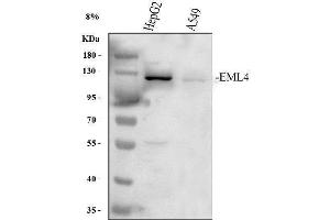Western blot analysis of EML4 using anti-EML4 antibody (ABIN6719384). (EML4 anticorps  (AA 207-423))