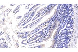 Detection of APC in Rat Small intestine Tissue using Polyclonal Antibody to Adenomatosis Polyposis Coli Protein (APC) (APC anticorps  (AA 2634-2842))