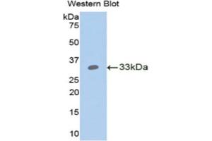 Western blot analysis of the recombinant protein. (ANGPTL4 anticorps  (AA 183-401))