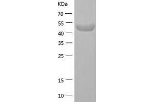 Western Blotting (WB) image for PBX/knotted 1 Homeobox 1 (PKNOX1) (AA 1-436) protein (His-IF2DI Tag) (ABIN7124326)