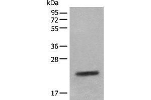 Western blot analysis of Mouse eye tissue lysate using CRYGS Polyclonal Antibody at dilution of 1:800 (CRYGS anticorps)