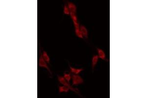 ABIN6274946 staining HT29 by IF/ICC. (CAGE1 anticorps  (C-Term))
