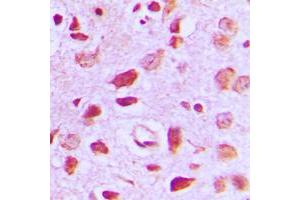 Immunohistochemical analysis of EIF5B staining in human brain formalin fixed paraffin embedded tissue section. (EIF5B anticorps  (C-Term))
