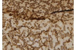 ABIN6277016 at 1/100 staining Mouse brain tissue by IHC-P. (Cbl Proto-Oncogene B, E3 Ubiquitin Protein Ligase (CBLB) (N-Term) anticorps)