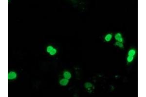 Image no. 2 for anti-Synovial Sarcoma, X Breakpoint 1 (SSX1) antibody (ABIN1501157) (SSX1 anticorps)