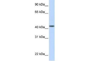 WB Suggested Anti-DENND1B Antibody Titration: 0. (DENND1B anticorps  (N-Term))