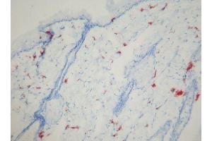 Image no. 1 for anti-Macrophages antibody (ABIN481694) (Macrophages anticorps)