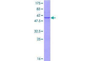 Image no. 1 for 3-hydroxybutyrate Dehydrogenase, Type 2 (BDH2) (AA 1-245) protein (GST tag) (ABIN1346613)
