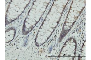 Immunoperoxidase of monoclonal antibody to CLIC1 on formalin-fixed paraffin-embedded human colon. (CLIC1 anticorps  (AA 1-241))