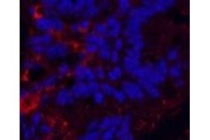 Immunofluorescence analysis of Mouse colon tissue using KIF7 Monoclonal Antibody at dilution of 1:200.