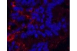 Immunofluorescence analysis of Mouse colon tissue using KIF7 Monoclonal Antibody at dilution of 1:200. (KIF7 anticorps)
