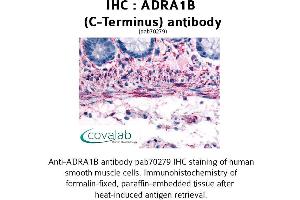 Image no. 1 for anti-Adrenergic, alpha-1B-, Receptor (ADRA1B) (C-Term), (Cytoplasmic Domain) antibody (ABIN1731575) (ADRA1B anticorps  (C-Term, Cytoplasmic Domain))