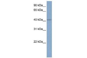KCNN4 antibody used at 1 ug/ml to detect target protein. (KCNN4 anticorps  (C-Term))