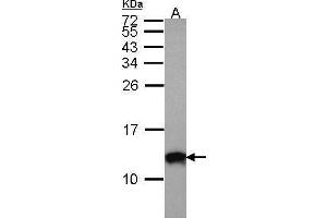 WB Image Sample (30 ug of whole cell lysate) A: A431 , 15% SDS PAGE antibody diluted at 1:1000 (S100A10 anticorps)