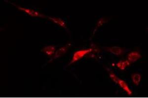 ABIN6278583 staining  HuvEc cells by IF/ICC. (IP6K2 anticorps  (Internal Region))