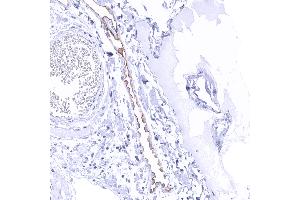 Distinct Upk3b immunostaining of apical membranes of peritoneal mesothelial cells (Uroplakin 3B anticorps)