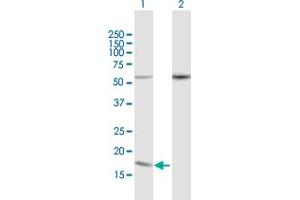Western Blot analysis of PDCD5 expression in transfected 293T cell line by PDCD5 MaxPab polyclonal antibody. (PDCD5 anticorps  (AA 1-125))