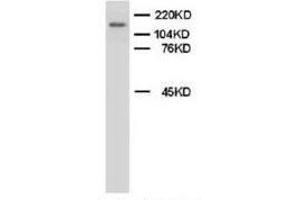Western blot analysis of rat brain tissue lysis using Myeloperoxidase antibody (Myeloperoxidase anticorps  (C-Term))