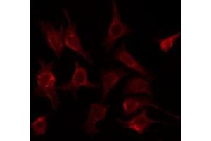 ABIN6275726 staining HeLa by IF/ICC. (CREB3L2 anticorps  (Internal Region))