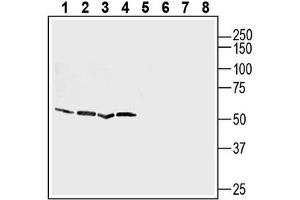 anti-Chemokine (C-X-C Motif) Receptor 4 (CXCR4) (AA 2-15), (Extracellular), (N-Term) antibody
