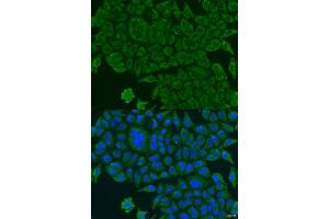 Immunofluorescence analysis of U2OS cells using BCS1L antibody.