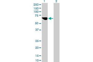 Western Blot analysis of MLYCD expression in transfected 293T cell line by MLYCD MaxPab polyclonal antibody. (MLYCD anticorps  (AA 1-493))