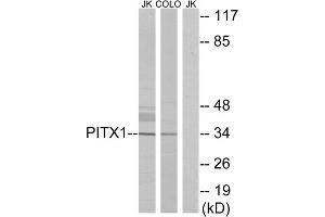 Western blot analysis of extracts from Jurkat cells and COLO cells, using PITX1 antibody. (PITX1 anticorps  (Internal Region))