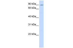 WB Suggested Anti-ATP2C1 Antibody Titration:  0. (ATP2C1 anticorps  (C-Term))