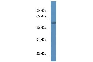 WB Suggested Anti-TADA2L Antibody Titration:  0. (TADA2L anticorps  (C-Term))