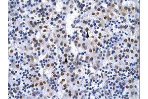 Image no. 2 for anti-X-Ray Repair Complementing Defective Repair in Chinese Hamster Cells 6 (XRCC6) (AA 98-147) antibody (ABIN202810)