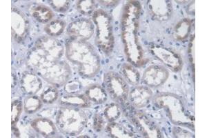 DAB staining on IHC-P; Samples: Human Kidney Tissue (ICA1 anticorps  (AA 1-258))