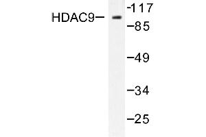 Image no. 2 for anti-Histone Deacetylase 9 (HDAC9) antibody (ABIN265461) (HDAC9 anticorps)
