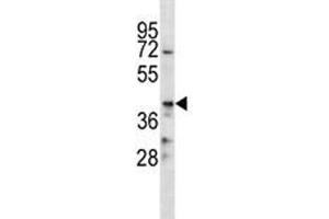 CD86 antibody western blot analysis in NCI-H292 lysate