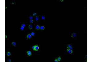 Immunofluorescence staining of A375 cells with ABIN7147325 at 1:100, counter-stained with DAPI. (MCAM anticorps  (AA 50-646))