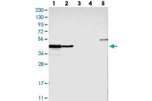 Western blot analysis of Lane 1: RT-4, Lane 2: U-251 MG, Lane 3: Human Plasma, Lane 4: Liver, Lane 5: Tonsil with PAWR polyclonal antibody  at 1:250-1:500 dilution. (PAWR anticorps)