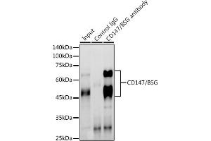 Immunoprecipitation analysis of 600 μg extracts of Mouse brain using 3 μg CD147/BSG antibody (ABIN3022146, ABIN3022147, ABIN1512647 and ABIN6218629).