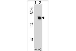 Western blot analysis of EIF4EBP1 (arrow) using rabbit polyclonal EIF4EBP1 Antibody (Center) (ABIN656558 and ABIN2845820).