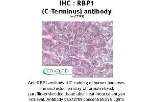 Image no. 1 for anti-Retinol Binding Protein 1, Cellular (RBP1) (C-Term) antibody (ABIN1738770) (RBP1 anticorps  (C-Term))