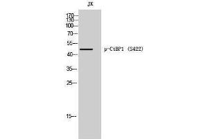 Western Blotting (WB) image for anti-C-terminal Binding Protein 1 (CTBP1) (pSer422) antibody (ABIN3182694) (CTBP1 anticorps  (pSer422))