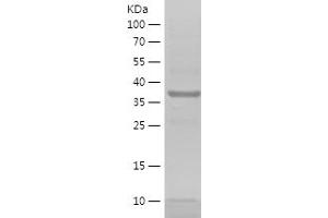 Western Blotting (WB) image for Secreted and Transmembrane 1 (SECTM1) (AA 69-248) protein (His-IF2DI Tag) (ABIN7124999)
