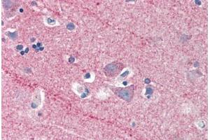 Human Brain, Cortex (formalin-fixed, paraffin-embedded) stained with ICAM5 antibody ABIN337181 at 5 ug/ml followed by biotinylated anti-goat IgG secondary antibody ABIN481715, alkaline phosphatase-streptavidin and chromogen. (ICAM5 anticorps  (AA 909-920))