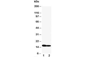Western blot testing of IFITM1 antibody and Lane 1:  SW620 (IFITM1 anticorps  (N-Term))